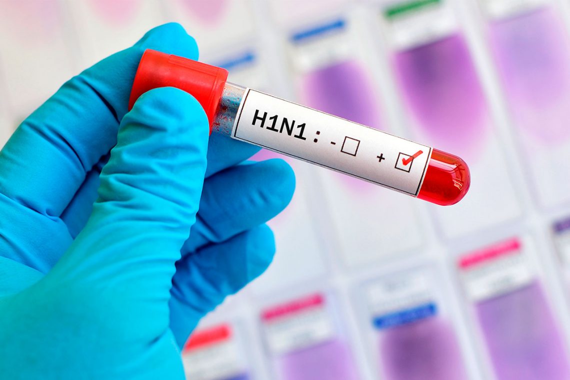 ГРИПП H1N1.СИМПТОМЫ И ЛЕЧЕНИЕ.