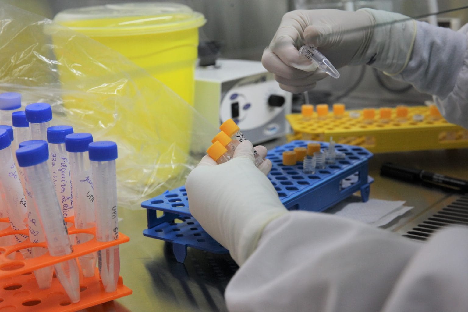 Covid19 com quantos dias o paciente deve realizar cada tipo de exame