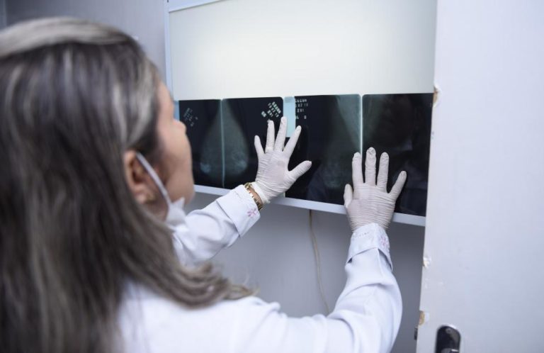 Novo mamógrafo do Cecon será instalado nas próximas semanas