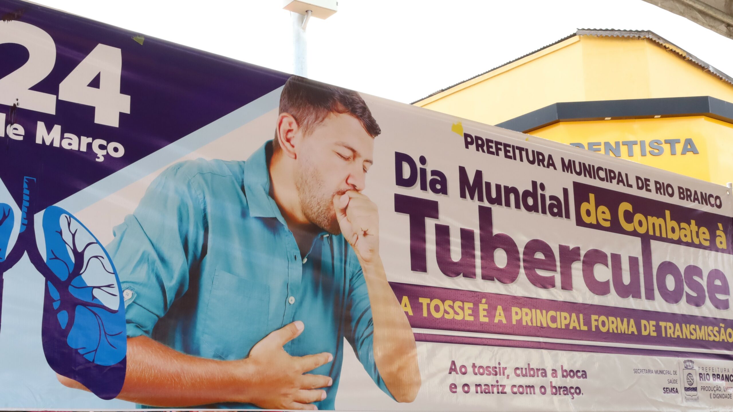 Governo do Acre e prefeituras promovem Semana Nacional de Mobilização e Luta contra a Tuberculose