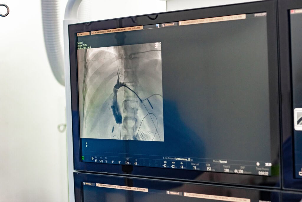 Foto: Gleison Luz/Fundhacre